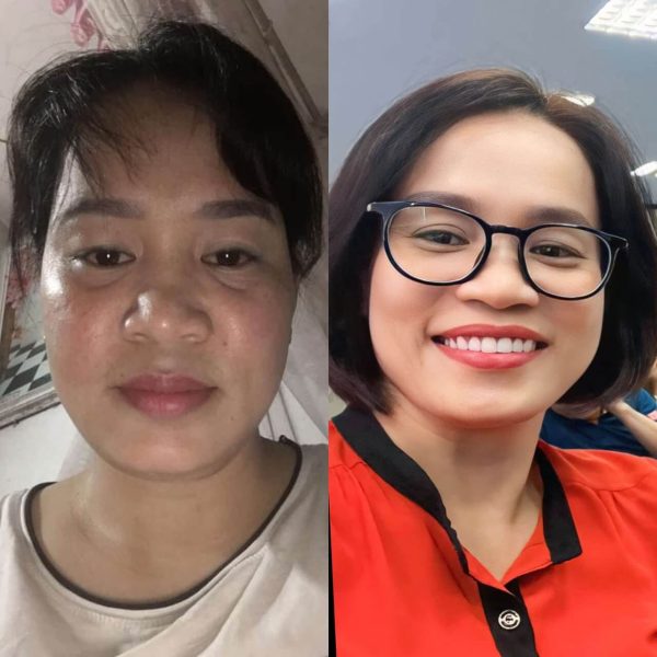 GÓI TRẺ – KHỎE – THỊNH VƯỢNG - Ảnh 4