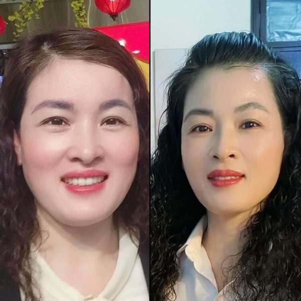 GÓI TRẺ – KHỎE – THỊNH VƯỢNG - Ảnh 8
