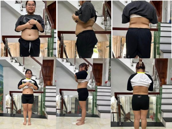 GÓI TRẺ – KHỎE – THỊNH VƯỢNG - Ảnh 12
