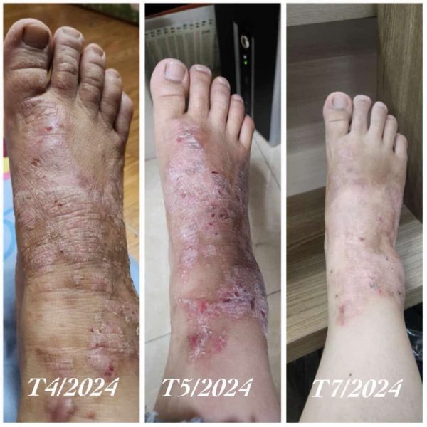 GÓI CHÌA KHÓA HỒI SINH - Ảnh 6