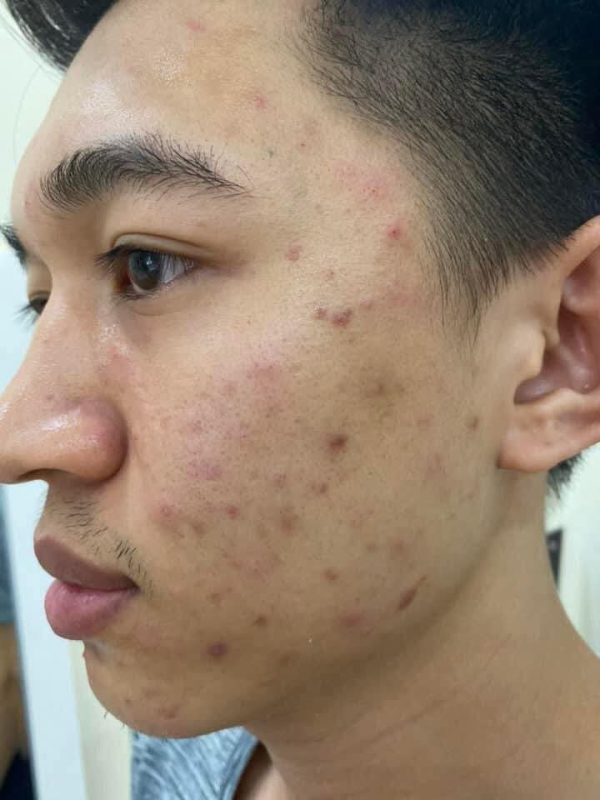GÓI CHÌA KHÓA HỒI SINH - Ảnh 8