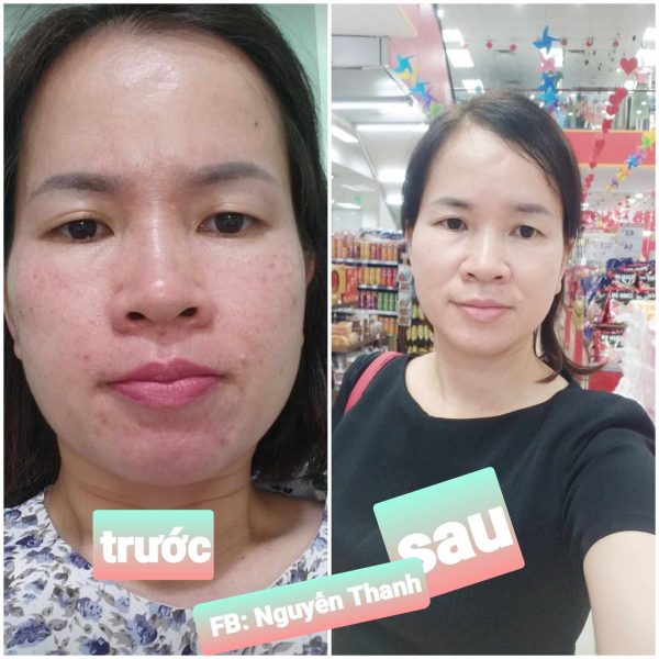 GÓI CHÌA KHÓA HỒI SINH - Ảnh 13